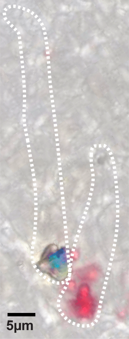 A section of a human retina. Dotted lines depict an individual green cone in blue and a red cone in pink