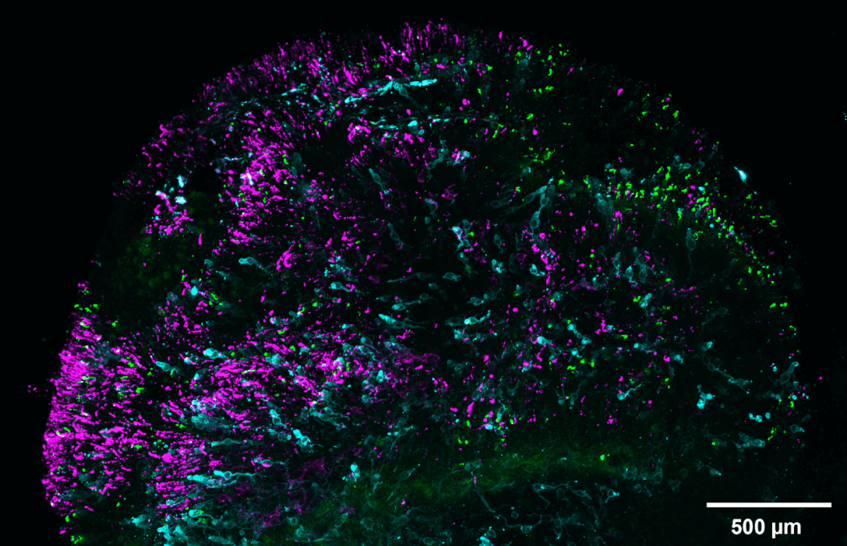 Retinal organoid marked to show blue cones in cyan and green/red cones in green. Cells called rods that help the eye see in low-light or dark conditions are marked in magenta.