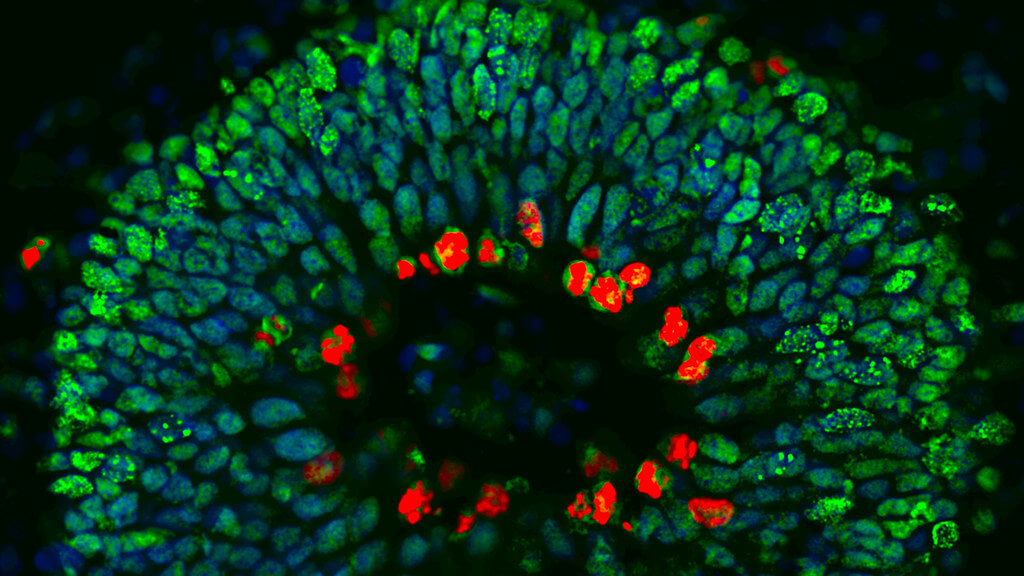 human brain organoid
