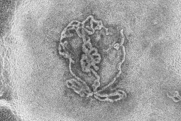 A bright field image of a testicular organoid created from mouse embryos and incubated in a dish for 14 days. The tubular structures formed in the dish are clearly visible