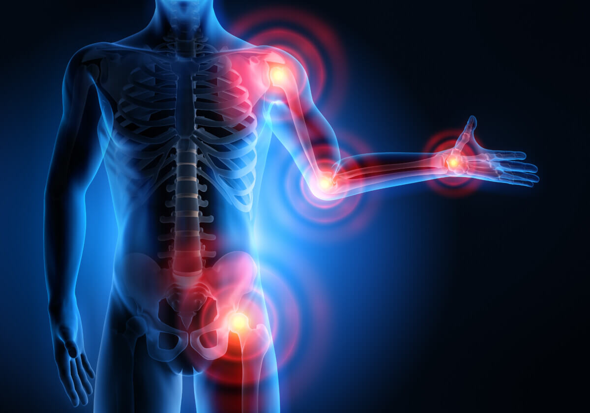 Points of arthritis throughout the body