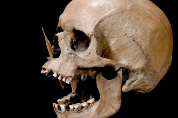 The Porsmose man from the Neolithic period, killed by two arrows with bone tips