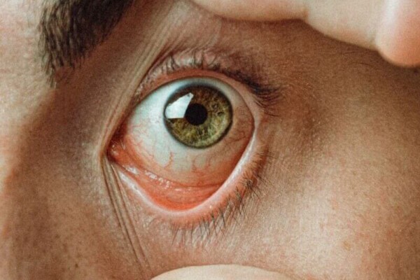man opening eye