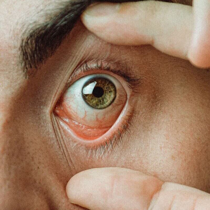 man opening eye