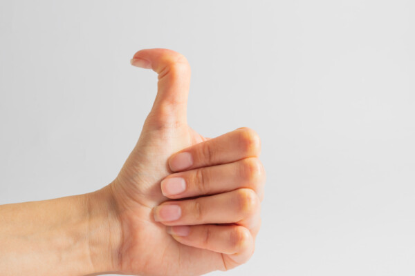 double jointed thumb