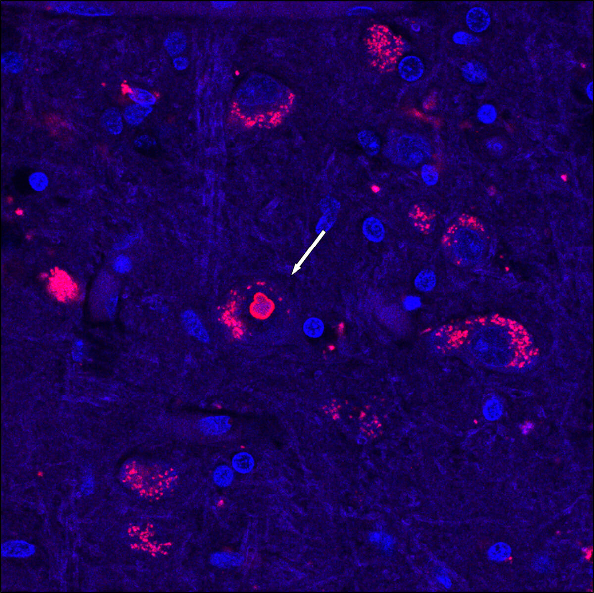 Brain tissue from a SCA4 patient
