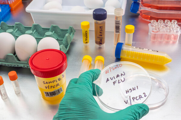 Lab tests for avian influenza (bird flu) strain H5N1