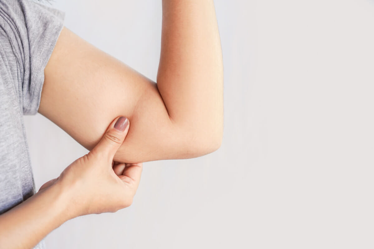 arm fat