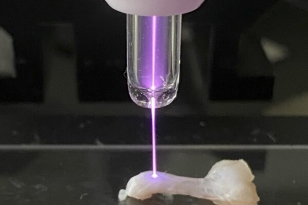 The Achilles tendon of a rat is irradiated with non-thermal atmospheric-pressure plasma.