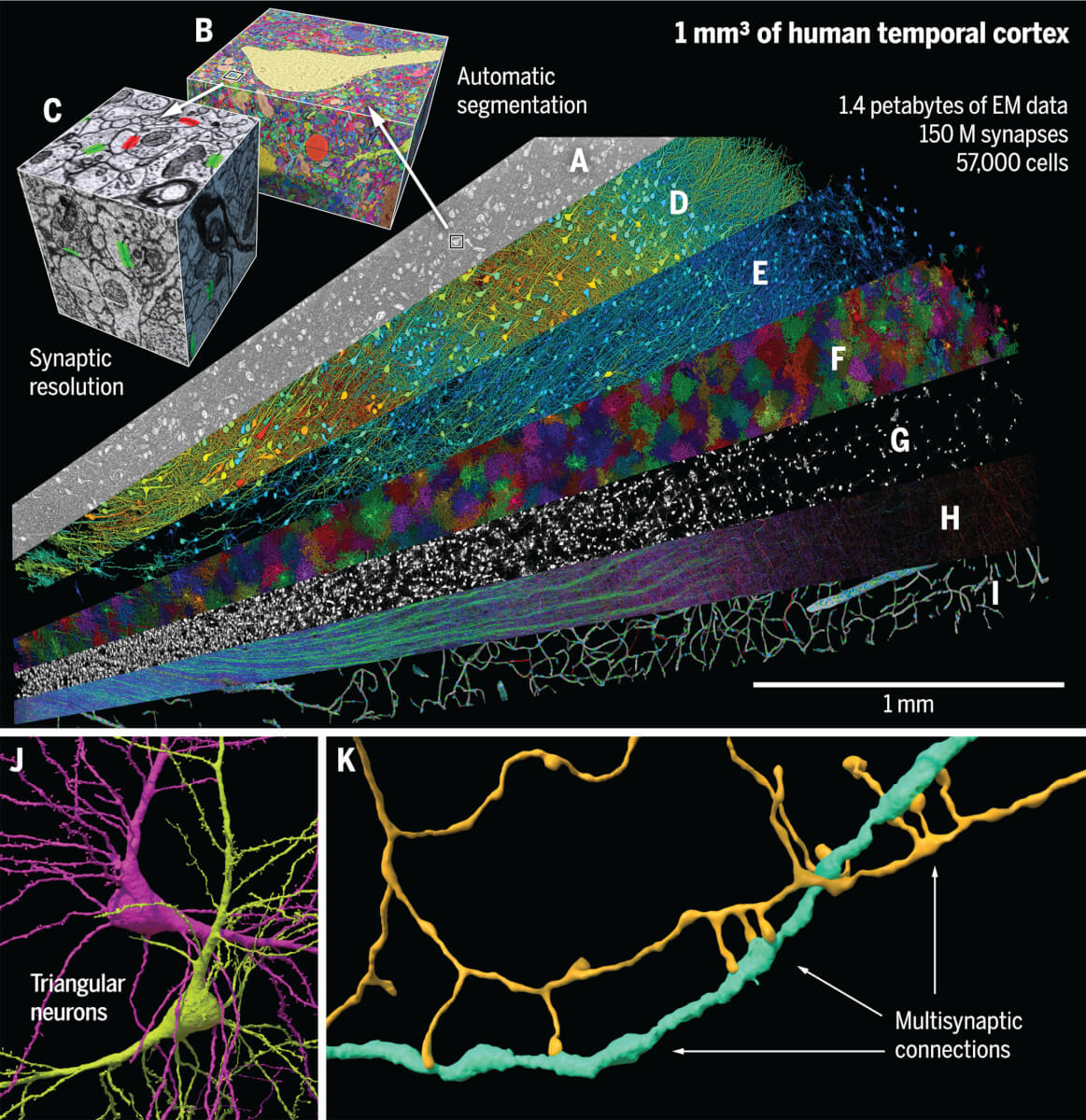 A range of histological features in 1 mm3 of the human brain mapped