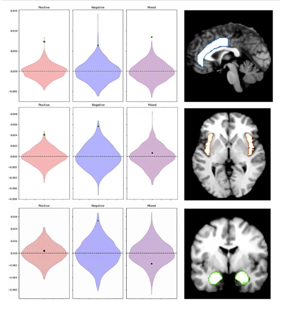 brain emotions