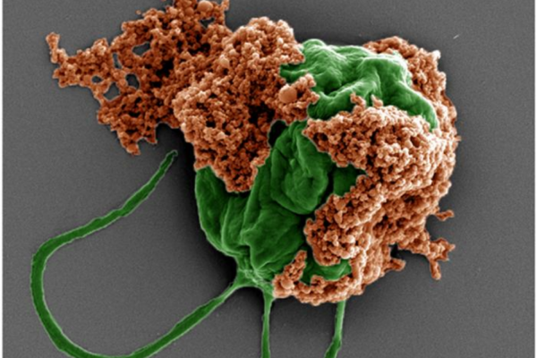 Colored SEM image of a microrobot made of an algae cell (green) covered with drug-filled nanoparticles (orange) coated with red blood cell membranes.