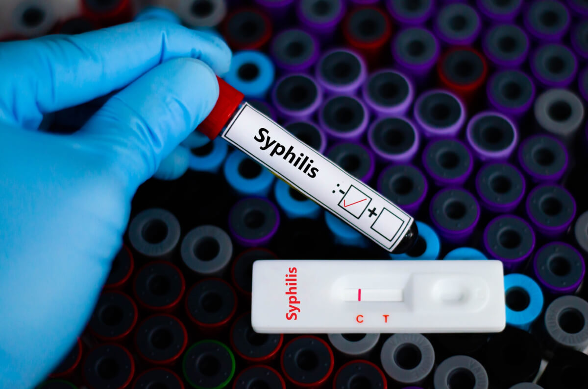 Scientists Find Lost Form Of Syphilis Bacteria In 5,500-Year-Old Remains