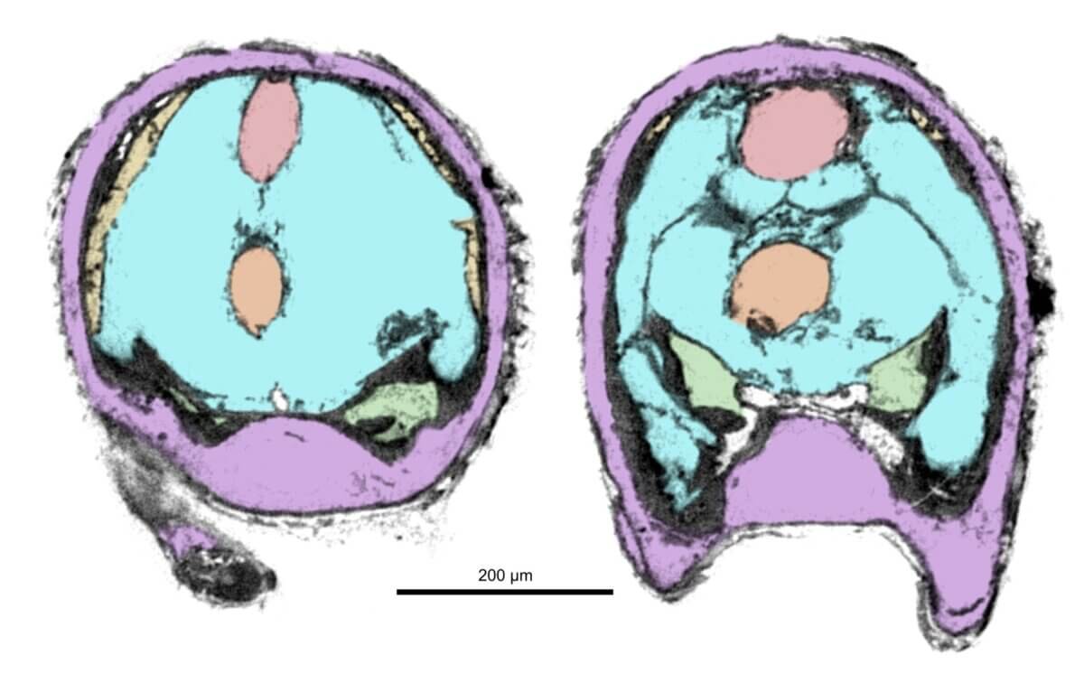 Slices through Youti yuanshi showing configuration of organ systems.