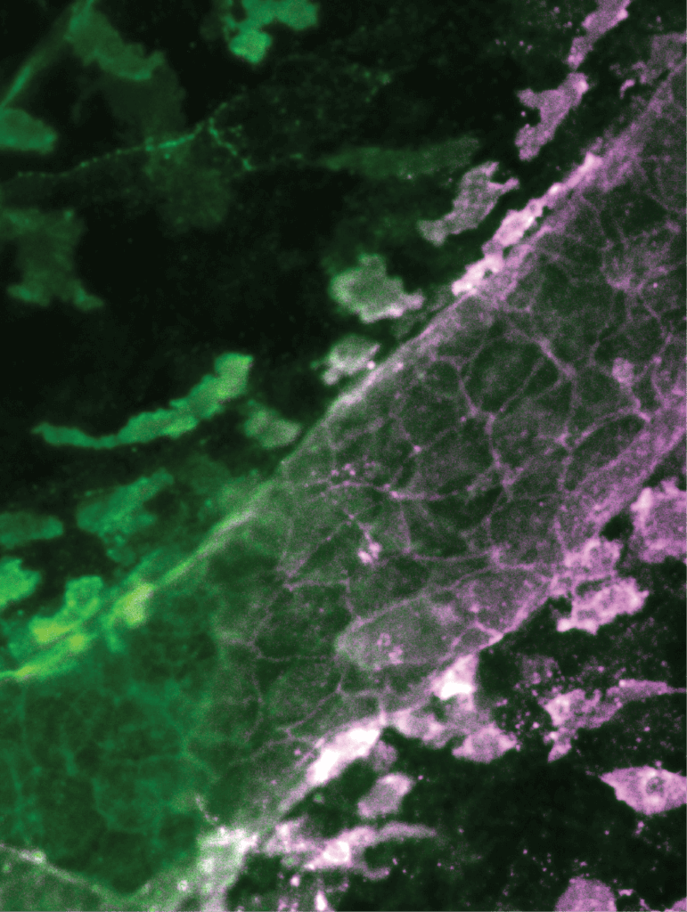 VE-cadherin staining of a murine meningeal lymphatic vessel, highlighting the cellular junctions which reorganize in response to CGRP signaling.