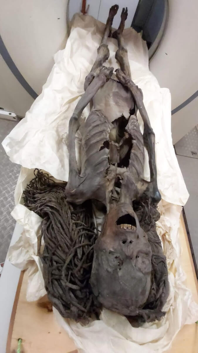 The Screaming Woman in the CT scan.