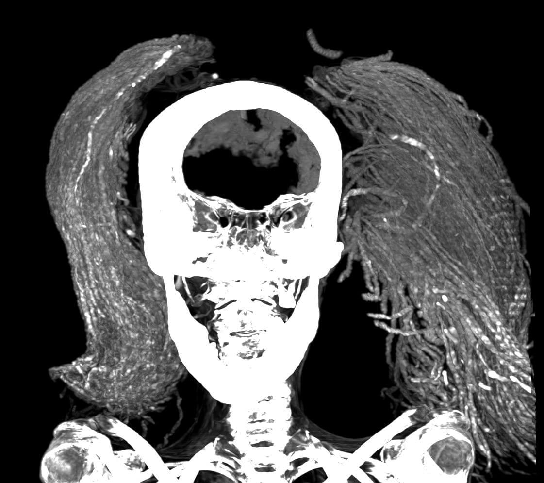 The mummy wearing her two-part wig