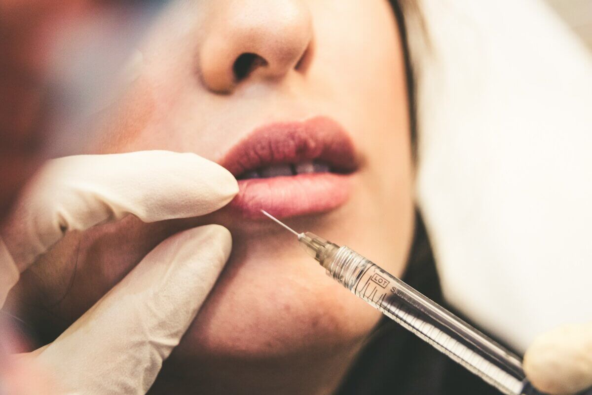 lip filler infection