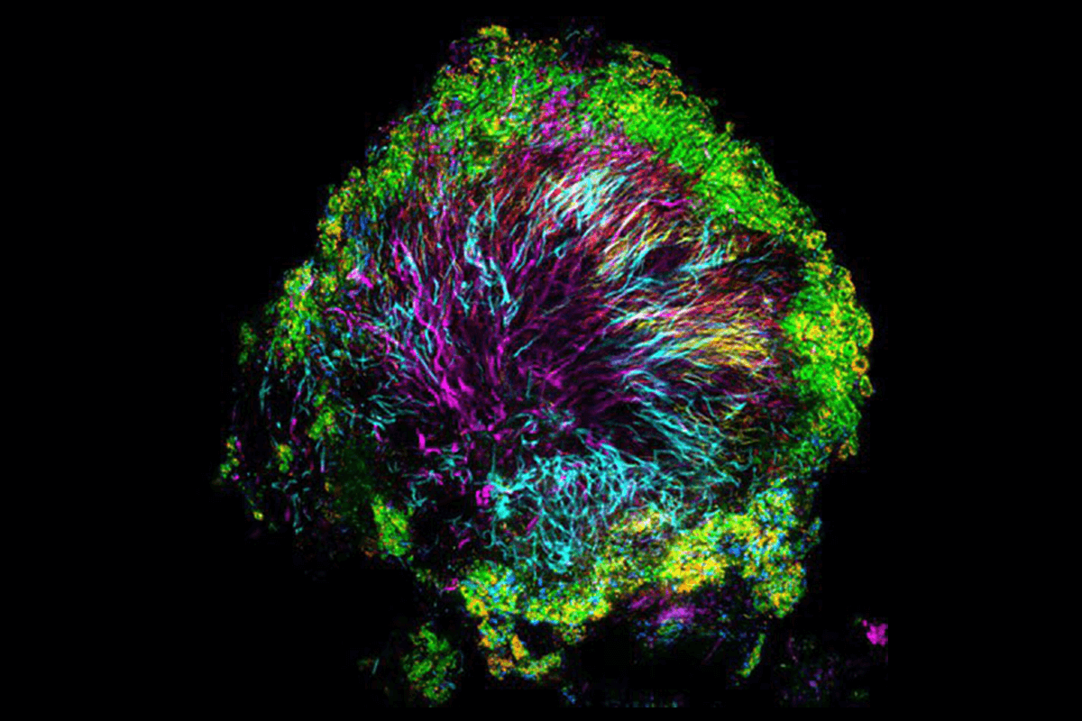 A “hedgehog” from dental plaque: a consortium of different bacterial species with a defined spatial structure. Corynebacteria matruchotii, shown in magenta, forms the core of the hedgehog.