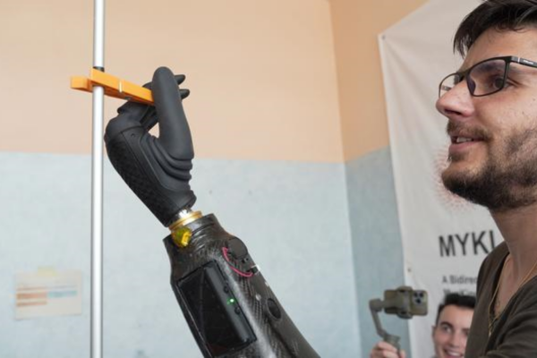 Experimental tests on robotic prosthesis: clothespin