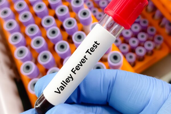 Valley Fever Disease Test