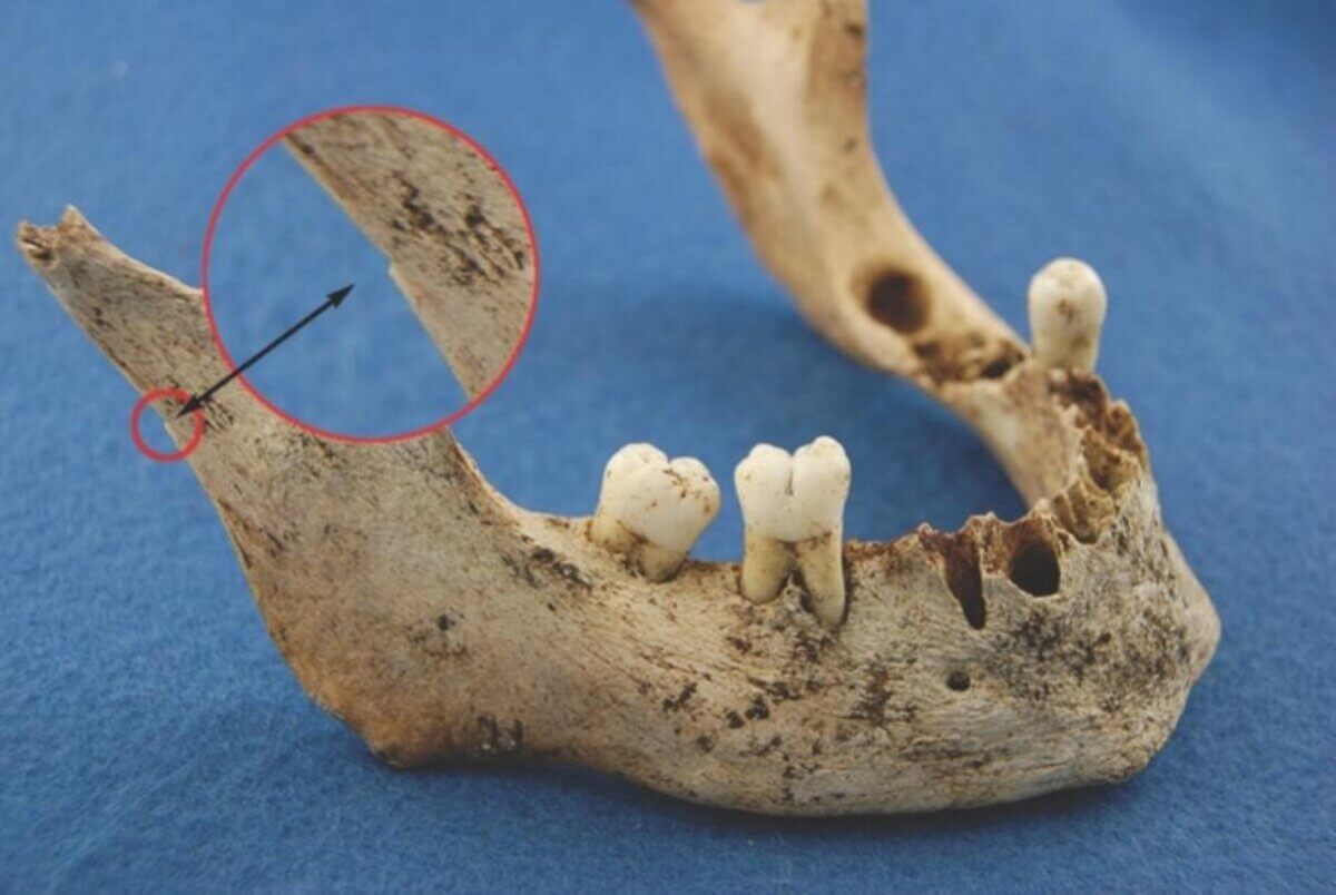 James Fitzjames jaw