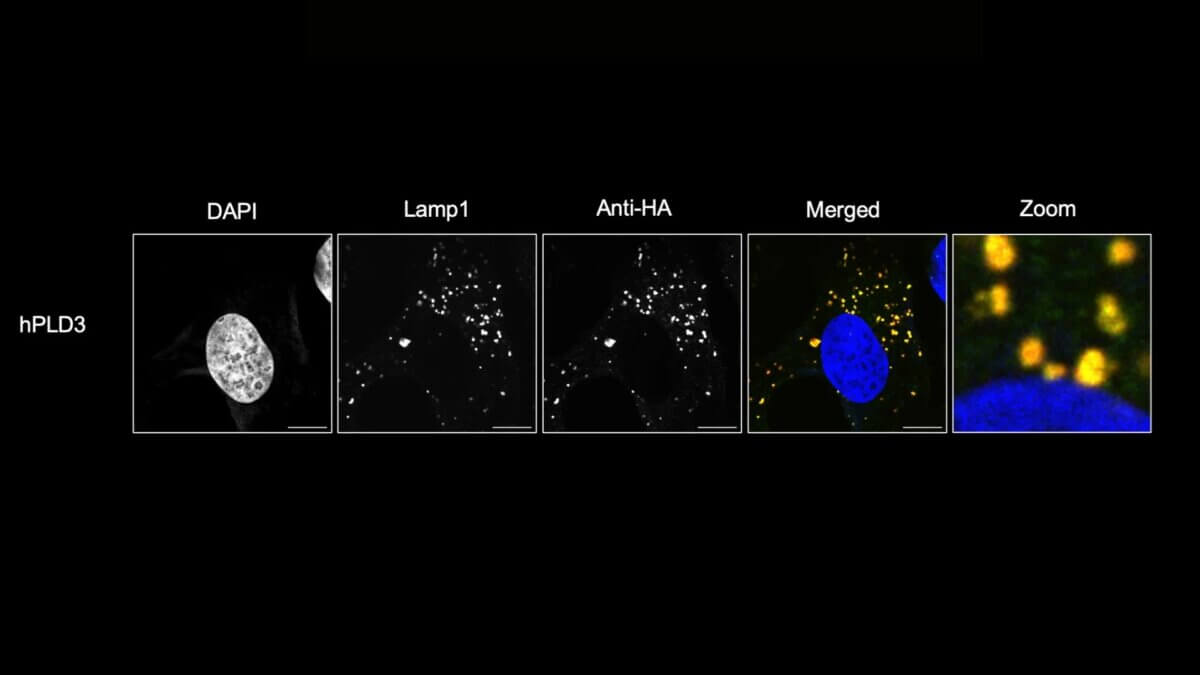 PLD3 is localized in the lysosomes of HMC3 microglial cells, a population of immune cells that play a key role in maintaining brain health. 