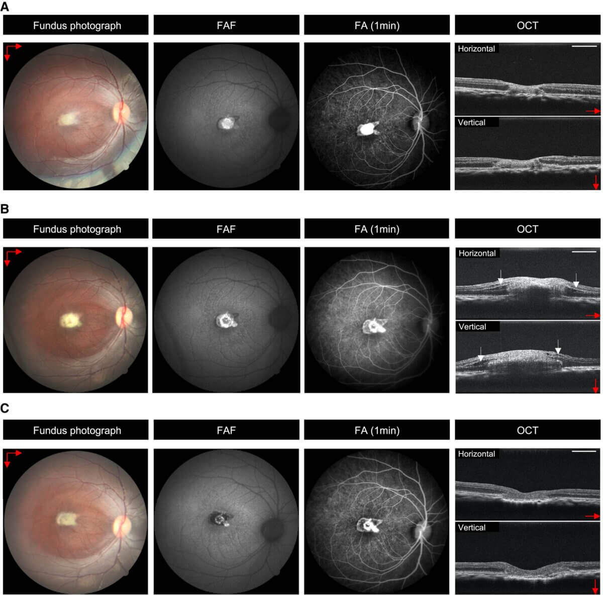 In vivo objective ophthalmic examinations after retinal transplantation to macular hole model monkey. 