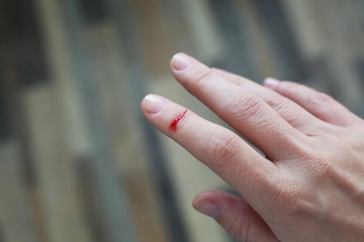 Finger bleeding from a paper cut