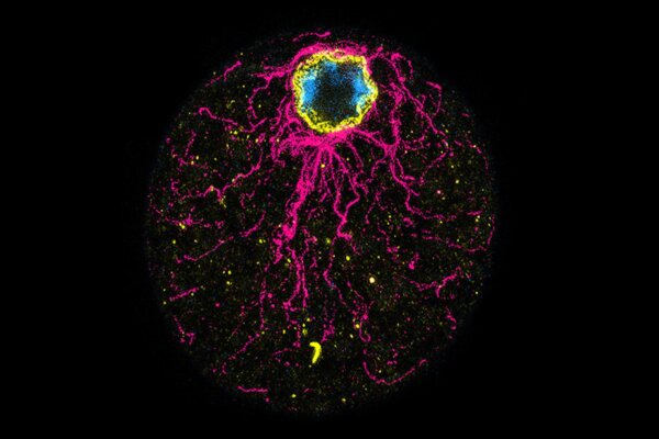 A cell of the ichthyosporean C. perkinsii showing distinct signs of polarity, with clear cortical localization of the nucleus before the first cleavage. Microtubules are shown in magenta, DNA in blue, and the nuclear envelope in yellow.