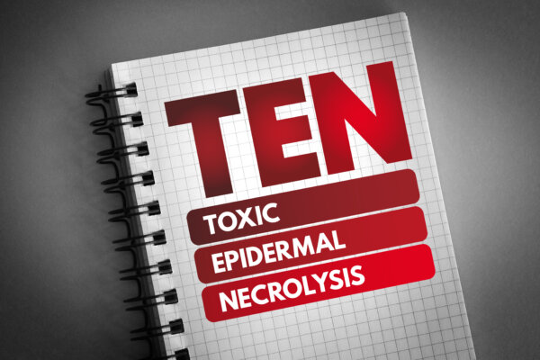 Toxic Epidermal Necrolysis