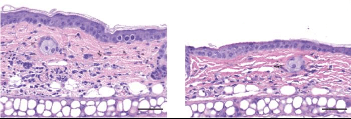 In a mouse model of contact dermatitis, preventive application of a cream containing SYM2081 (right image) reduced skin swelling compared to placebo (left image). 