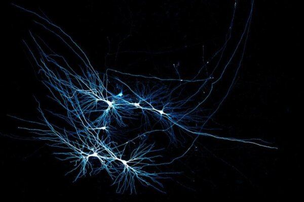 Human CA3 pyramidal neurons recorded in a patient tissue sample.