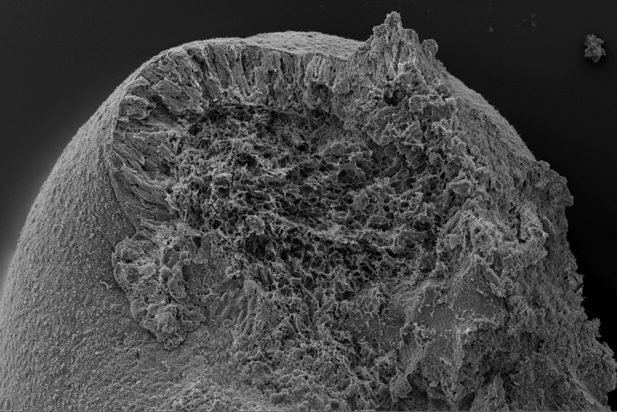 Electron scanning microscopy image showing a very detailed look at pieces of trunk organoids.