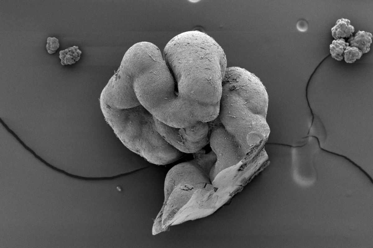 notochord