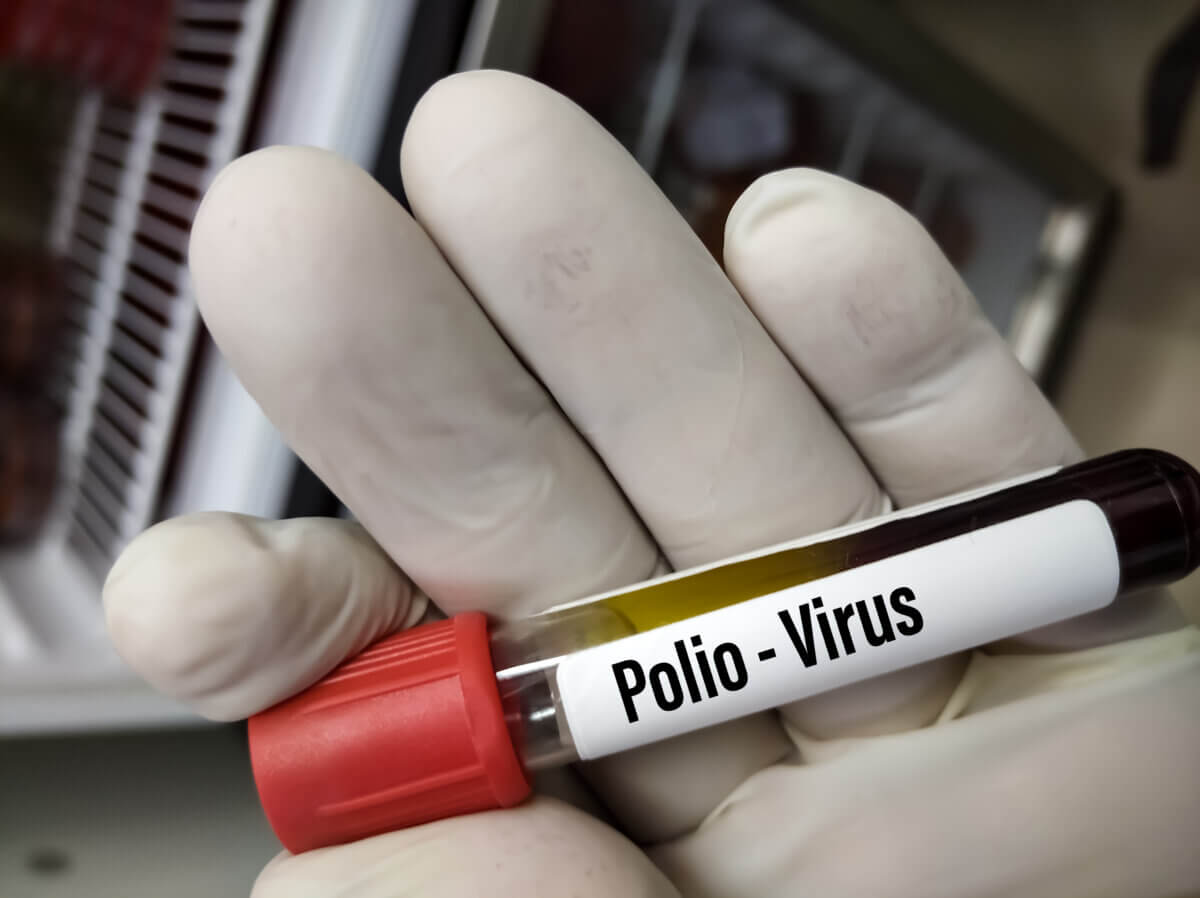 polio virus sample
