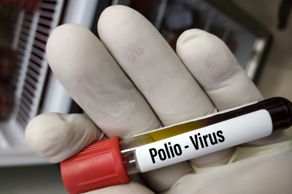 polio virus sample
