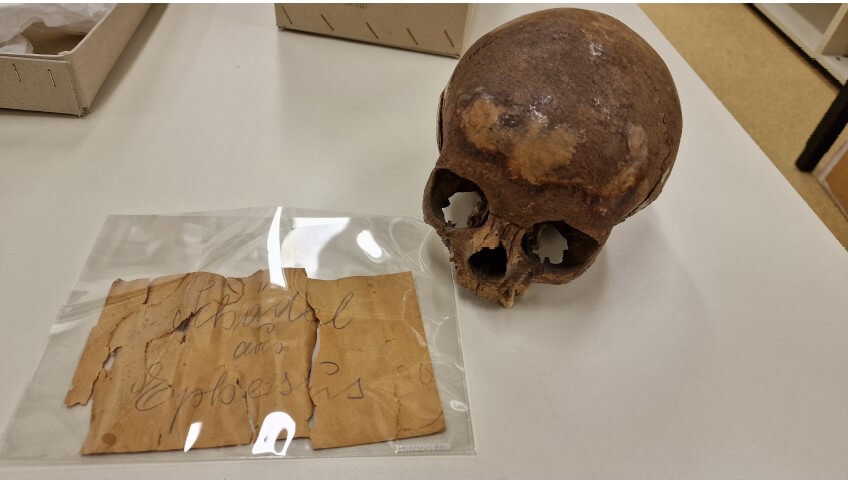 Ancient skull mystery