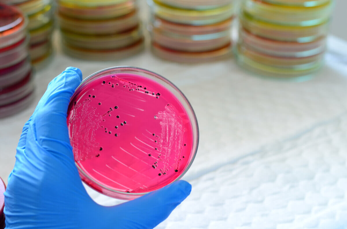Salmonella bacteria