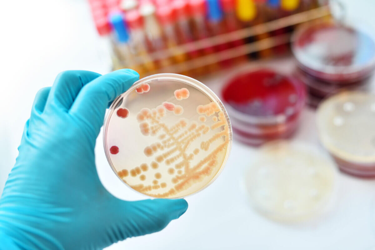 Bacteria in a petri dish