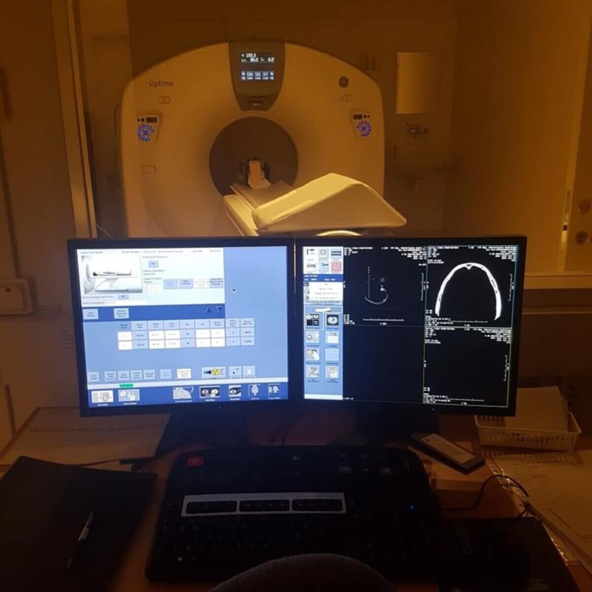 CT scans of Viking skulls