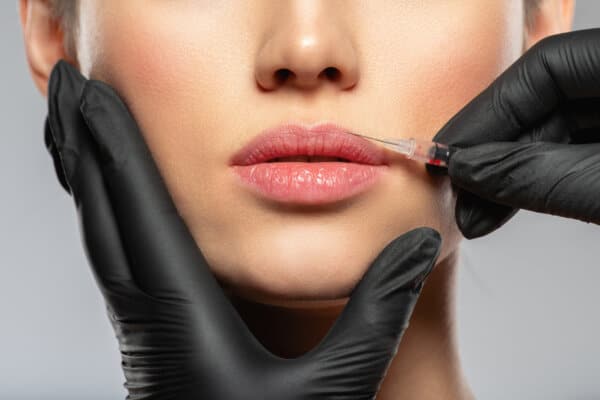A woman getting lip filler