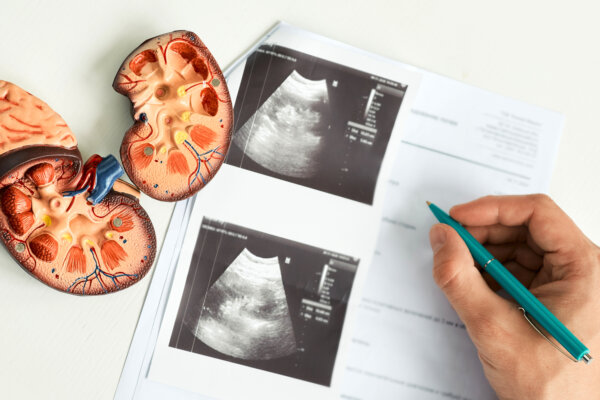 Kidney model with ultrasound images