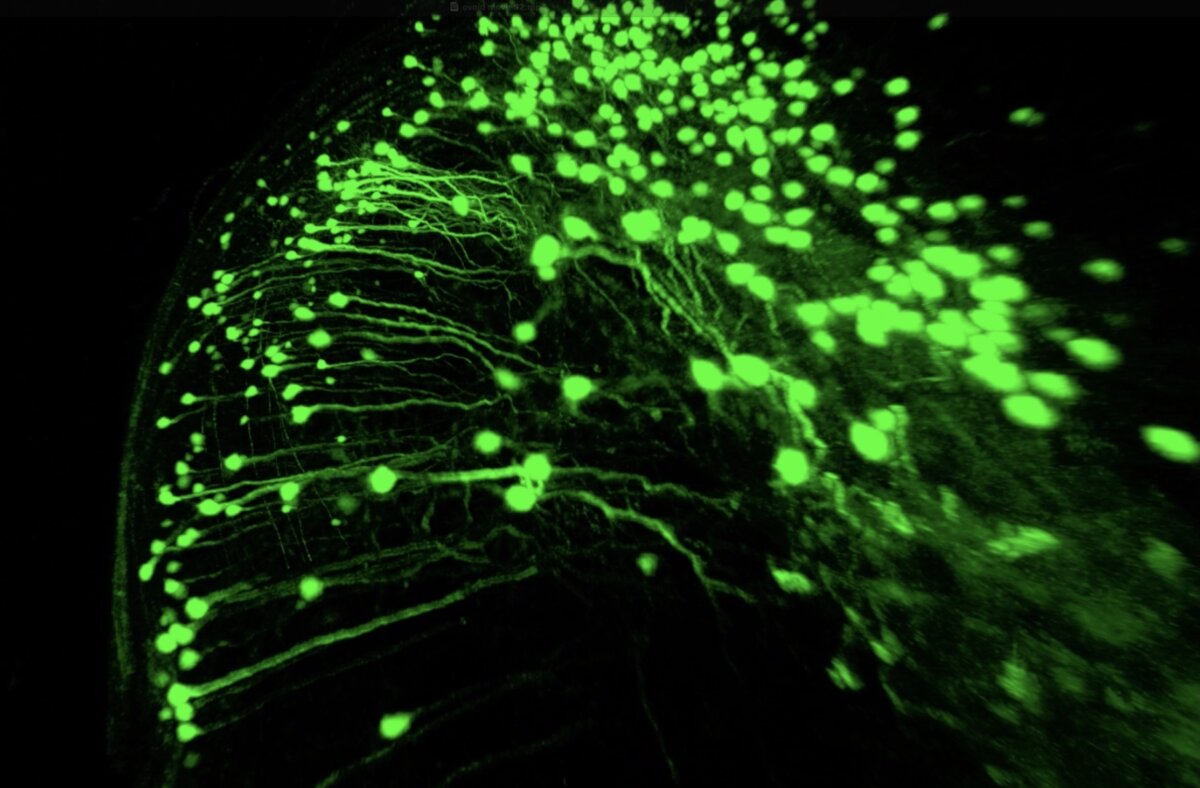 Ovoid cells active in the hippocampus of a mouse. 
