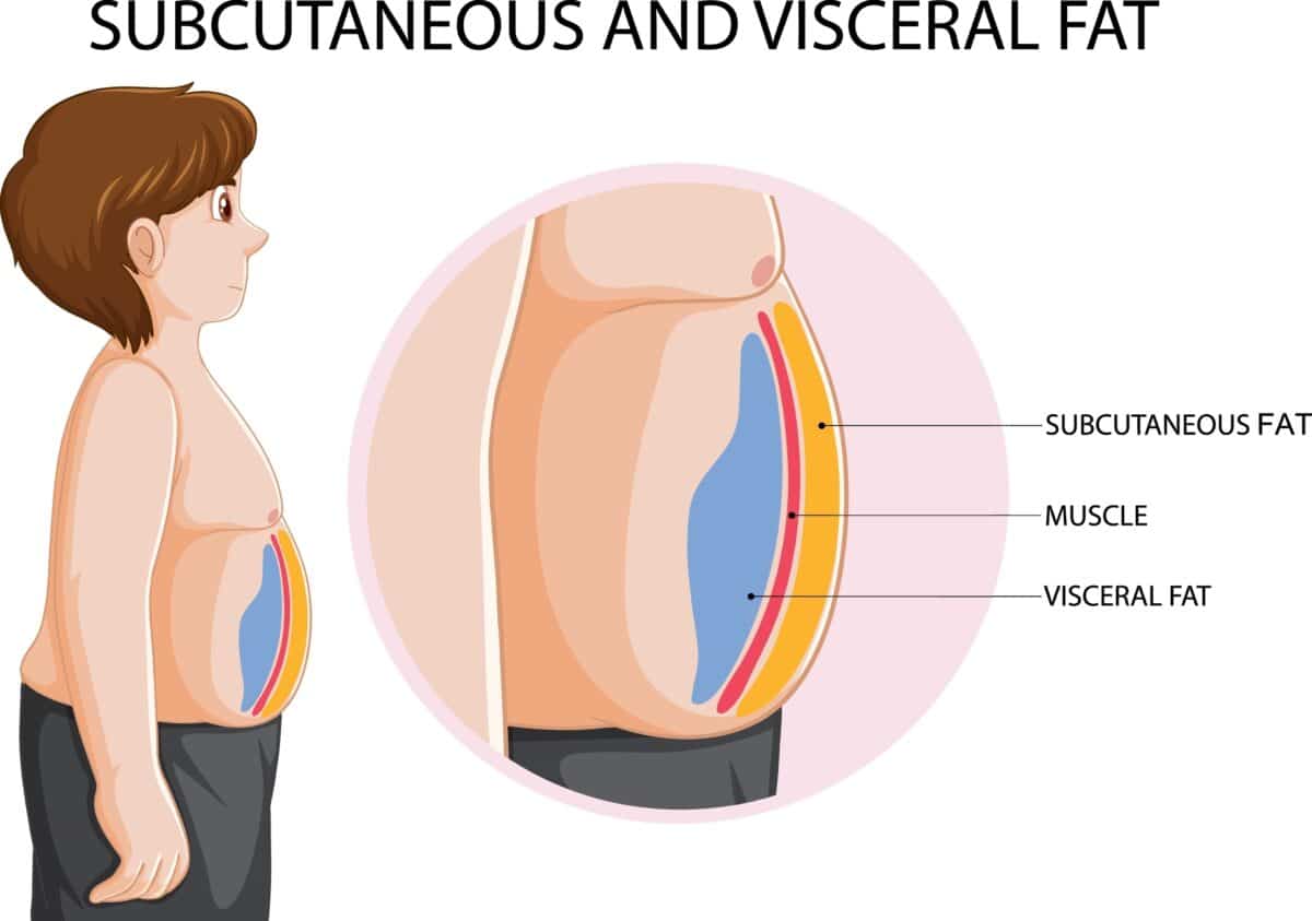An illustration of subcutaneous and visceral fat