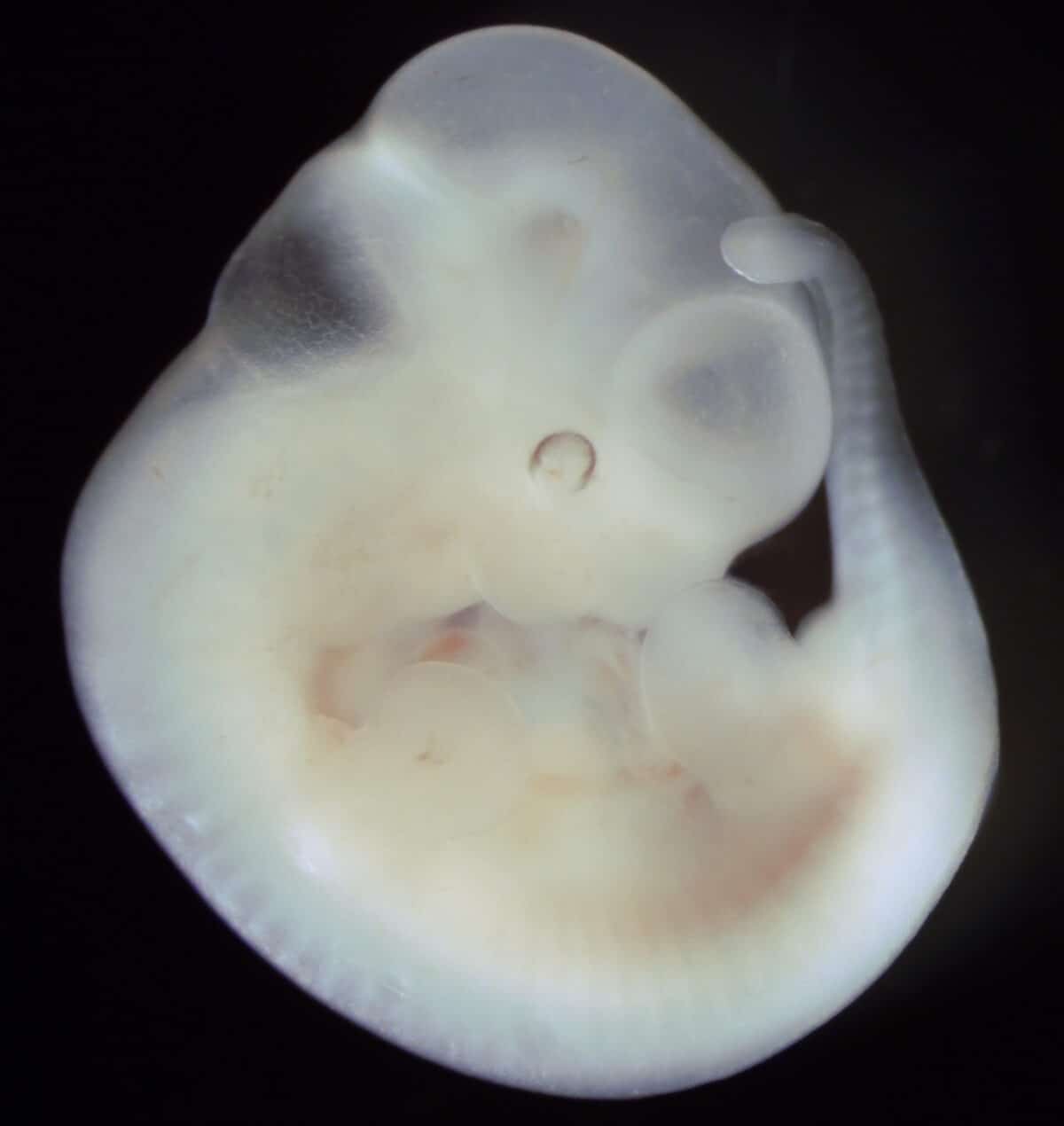 Mouse embryo, day 11 of development