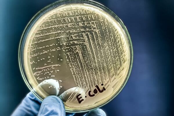 A microbiological culture Petri dish with a colonies of the pathogenic bacterium Escherichia coli (E. coli)