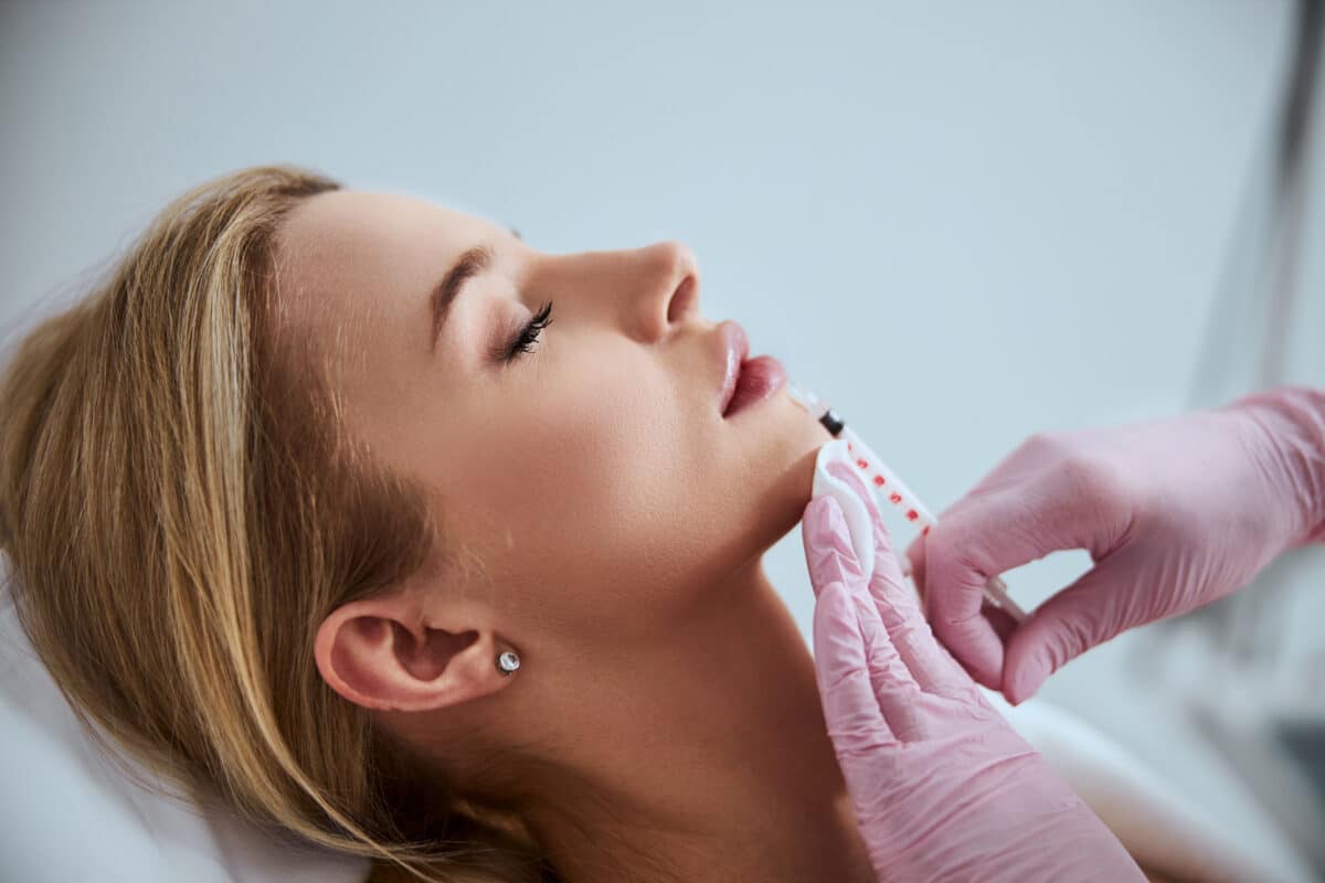 Lip filler