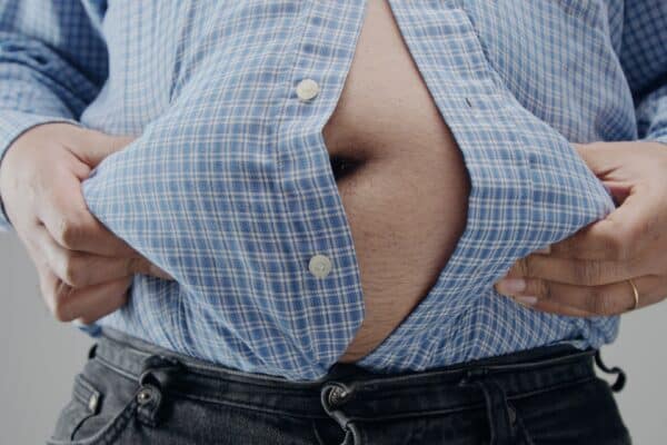 Overweight man with belly popping out of shirt