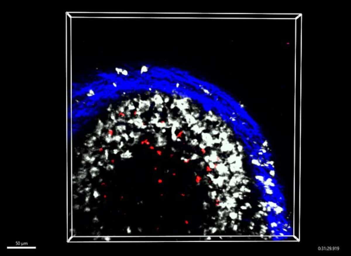 Memory B cells
